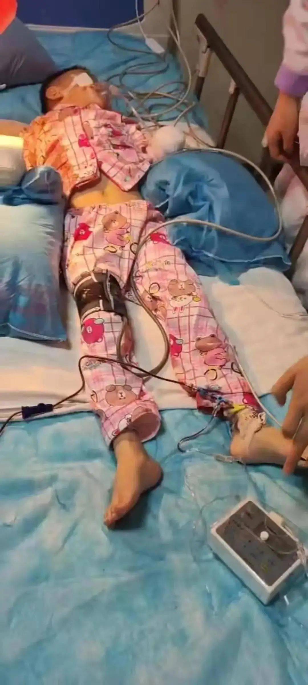 西宁一6岁男孩双手血肉模糊竟然是因为