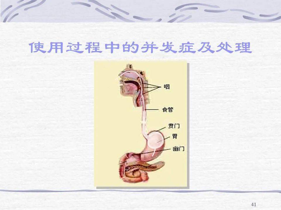 三腔二囊管的应用及护理