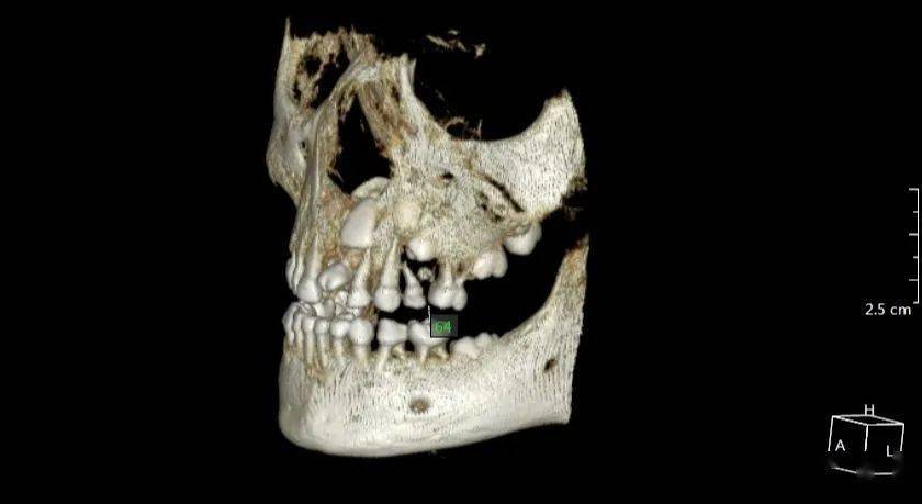 万xx 20210218 多生牙cbct 187xxxx1707