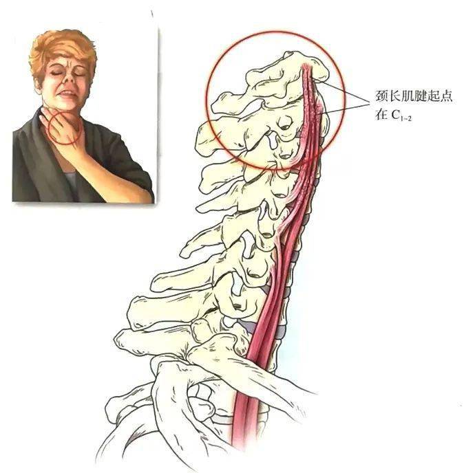 骨今中外 06 頸胸椎棘突間滑囊炎 臨床綜合徵 頸椎下部和胸椎上部的