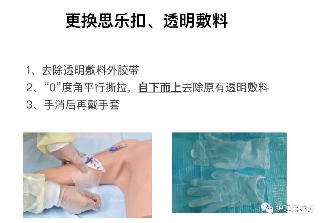 正压封管picc维护的重要步骤你做对了吗