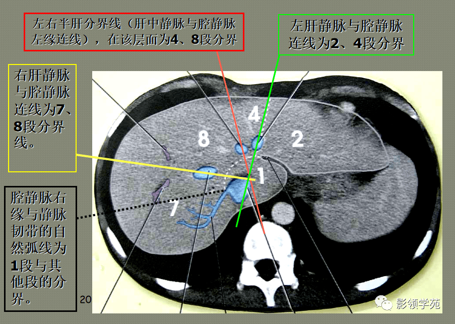 肝分叶分段ct解剖图图片