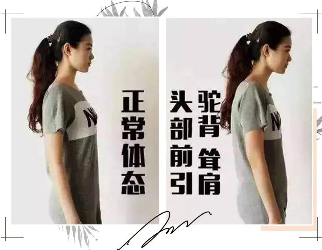 驼背和不驼背的女生穿同一件衣服差距居然这么大