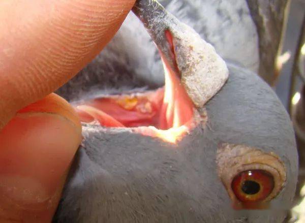 治疗毛滴虫新方法再也不用甲硝锉了