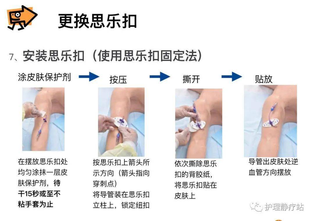 picc维护宣教图片图片