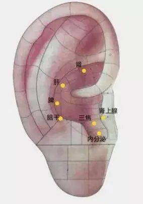 选穴:肝,肾,脾,三焦,内分泌,兴奋线,垂体,脑点,脑干,肾上腺,甲状腺,腰
