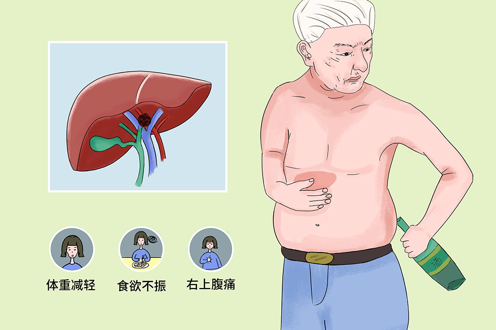 香港著名影星吴孟达因肝癌去世关于肝癌的那些事