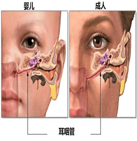 33愛耳日寶爸寶媽請注意保護孩子耳朵健康請遠離這些錯誤行為