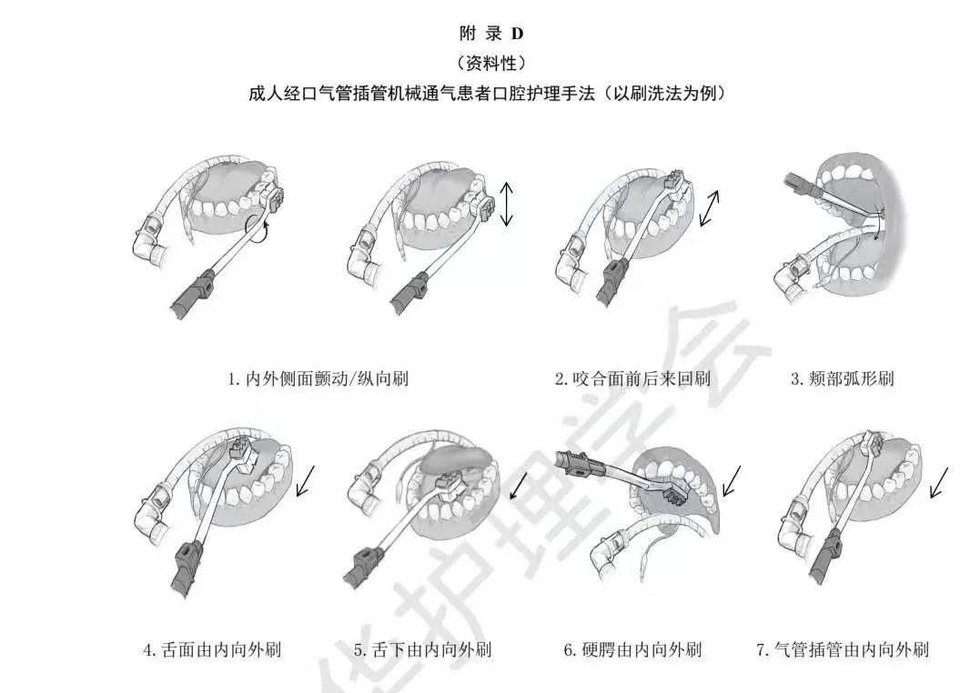 護理團體標準解讀:成人經口氣管插管機械通氣患者口腔護理