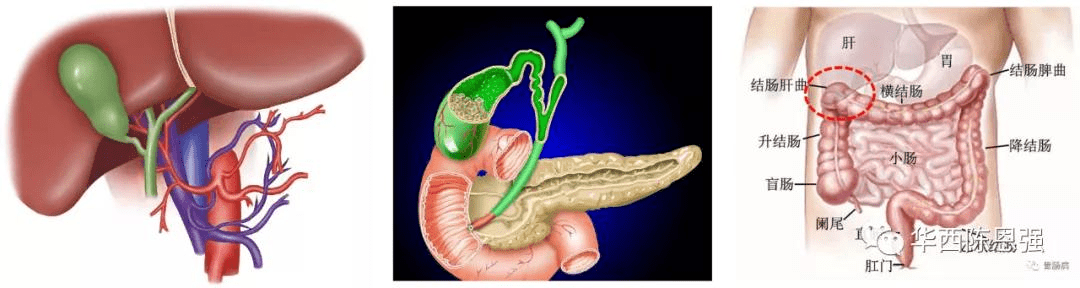 征,胆囊癌,肝曲结肠癌和肝(脾)曲综合征等也可出现右上腹不适感或疼痛