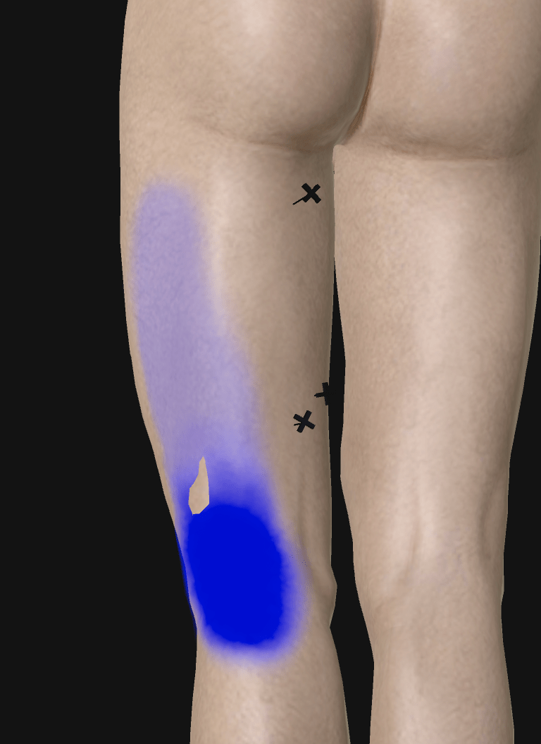 fd162fdcebe1413db2cf27b4bdc505b7.png