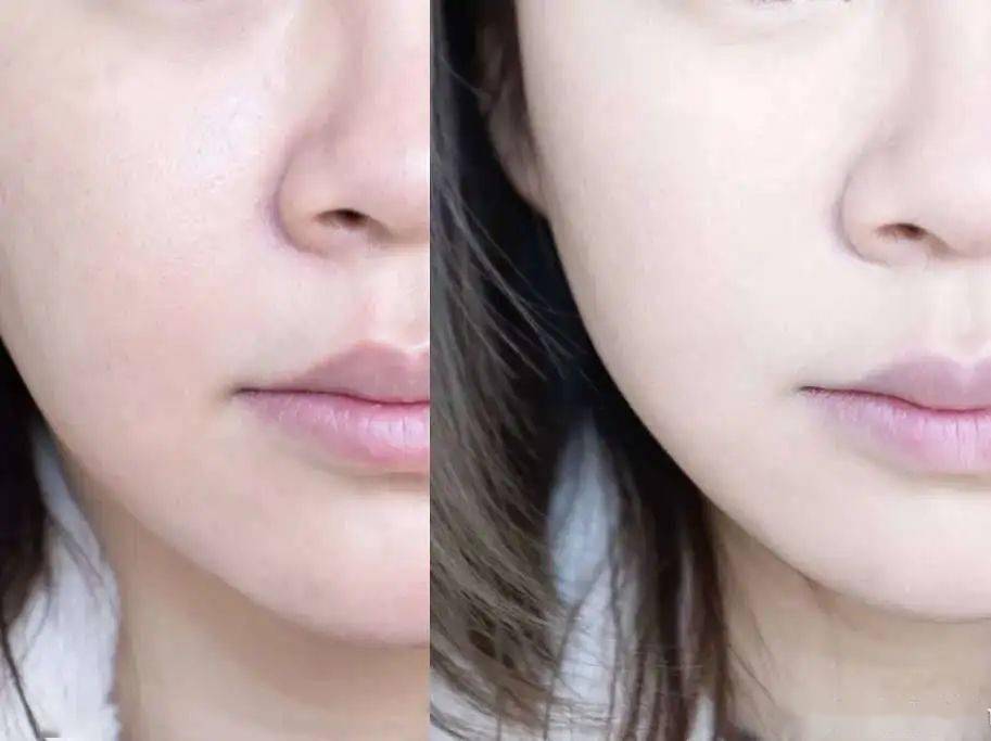 拍照有法令纹 7270506191824b04a1f9980378da519c.jpeg