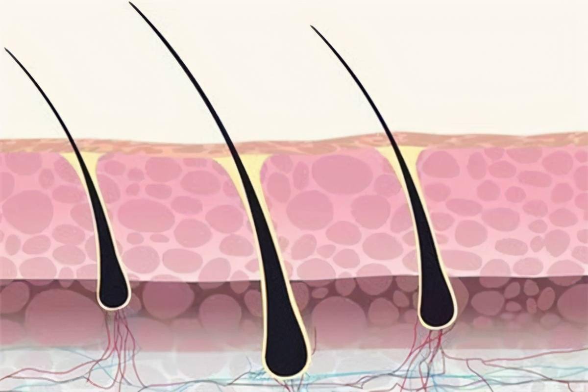 有毛囊的存在才能长出毛发,将鼻毛直接拔掉,鼻孔内的毛囊也会受损