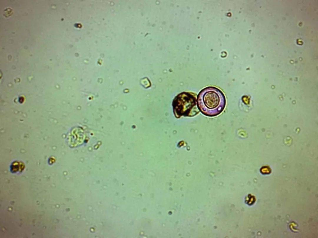 4 科普:落叶松有利于花粉扩散传播未来24小时气象条件花粉浓度较低no.