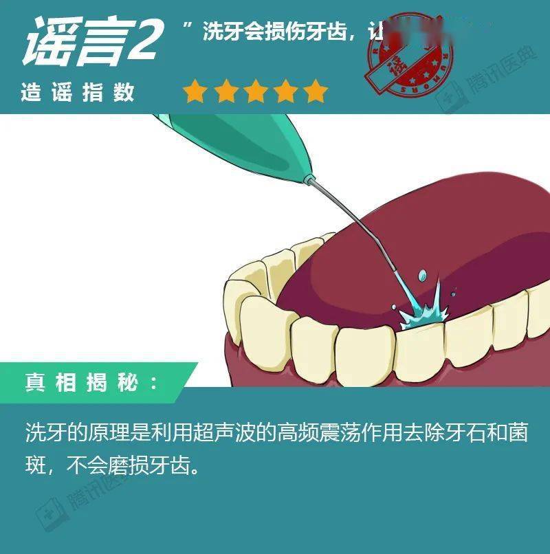 洗牙会疼还流血?8个洗牙传言别信