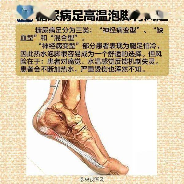 注意:这些人不能泡脚此外,马书玖指出,老年人,心脑血管病人,泡脚的