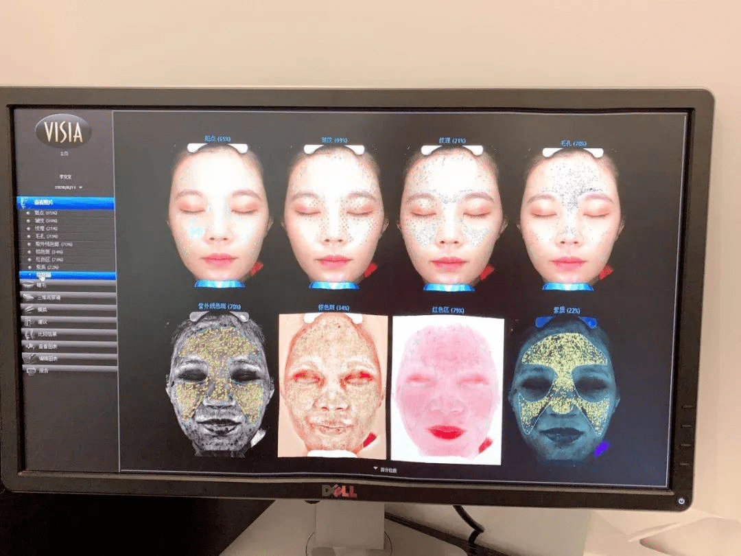 记一次真实的光子嫩肤体验仿佛打开了新世界