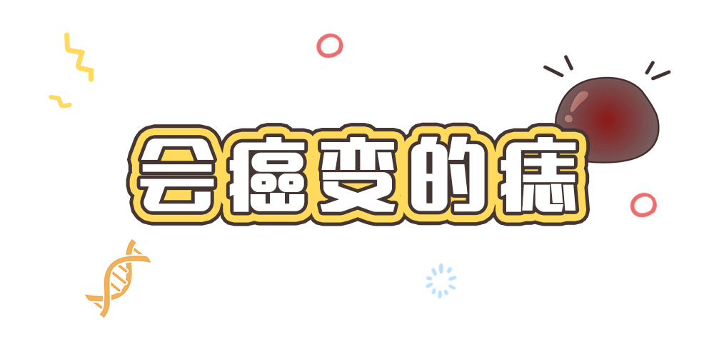 痣也可能会癌变!长在 3 个地方要注意