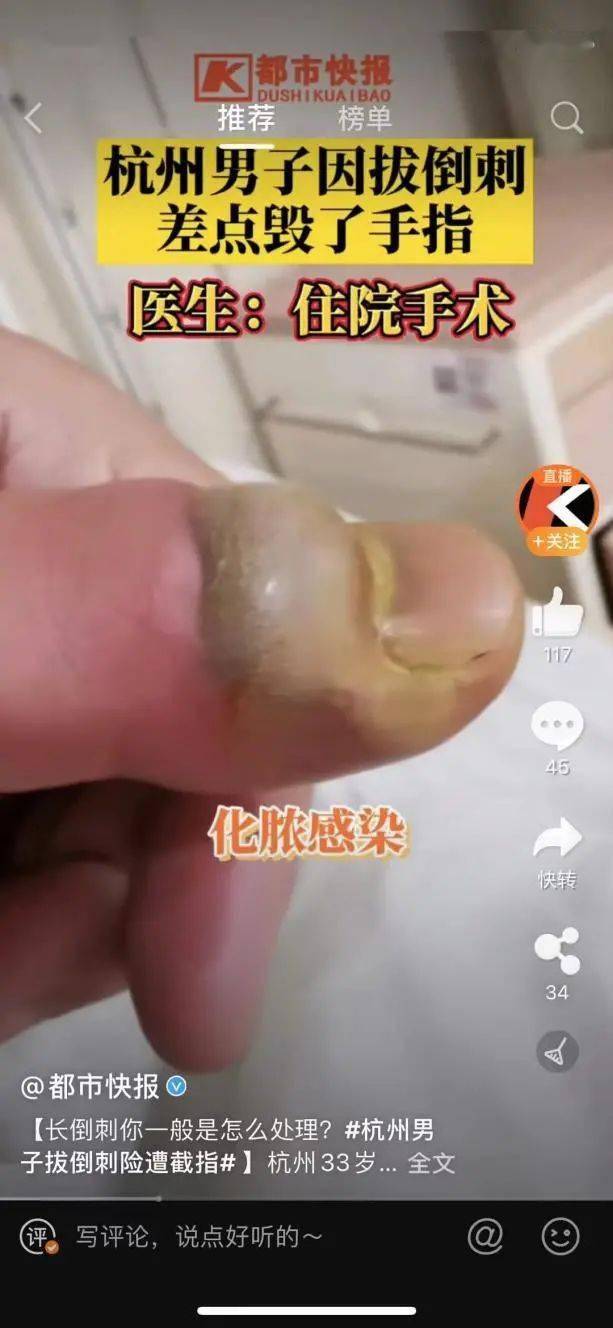 拔倒刺,撕嘴皮,挤痘痘,我咋管不住这手呢?