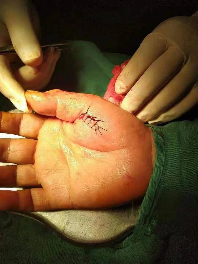 开了一瓶蚝油,十堰老人竟住进医院!厂家回应