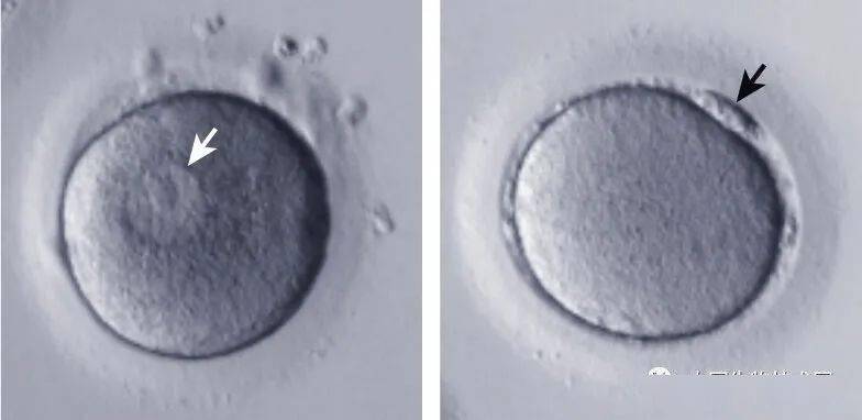 左側為未成熟的(gv期)卵母細胞,右側為成熟的(mii中期)卵母細胞近幾十