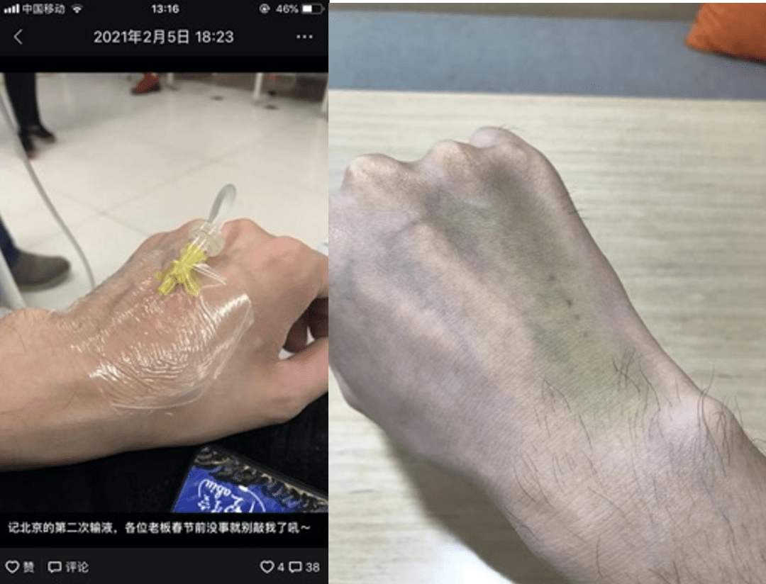 一盘小酥肉,让养生狂魔喜提腹痛暴击三部曲