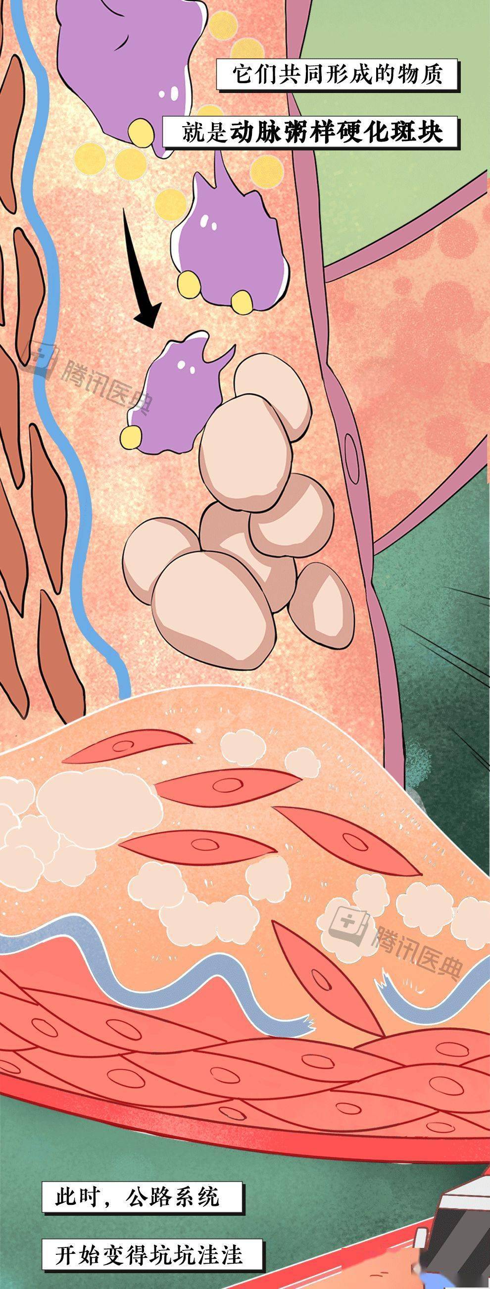 成年人血管堵塞全过程曝光