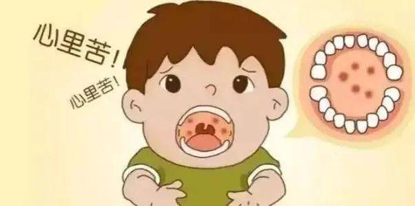 如何预防流口水 ca7fd553524a4e3c8842a94c8d87a5d7.jpeg