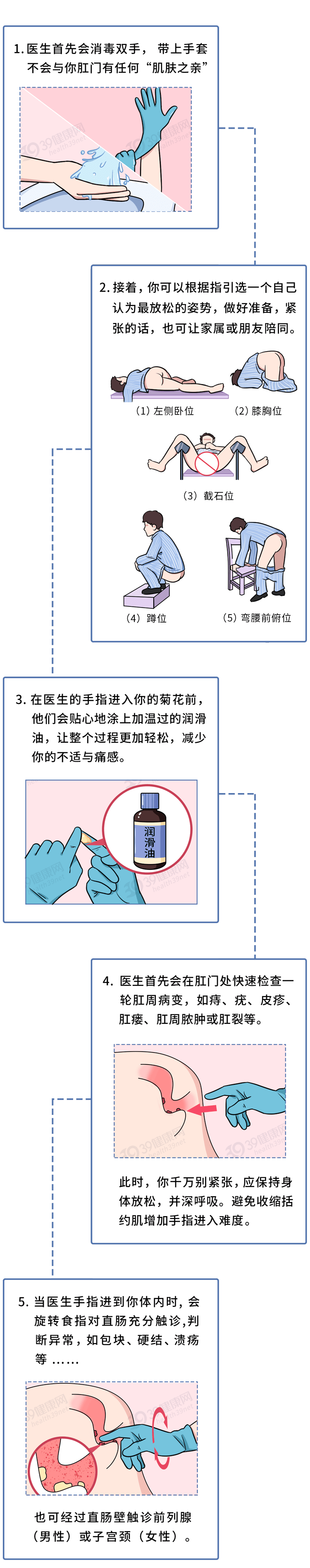 儿童肛门指检图片