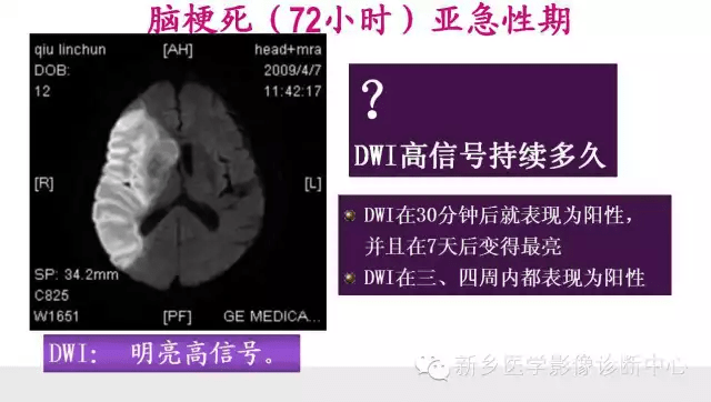 e2c79f9199ab4ae0857c4302080b251f.png