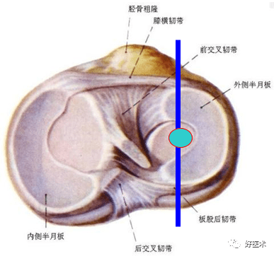 半月板详细解剖及损伤的详细讲解 韧带