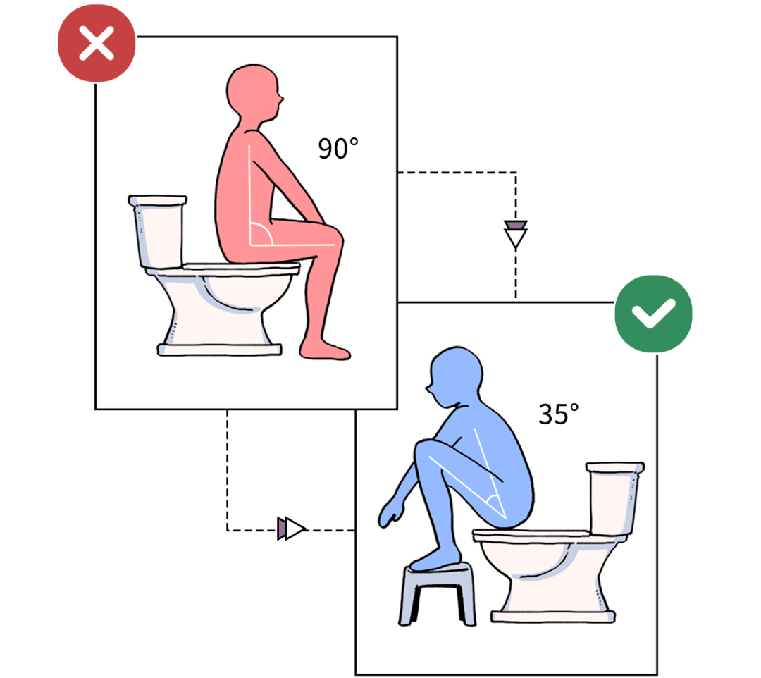 坐马桶怎么擦屁股图片