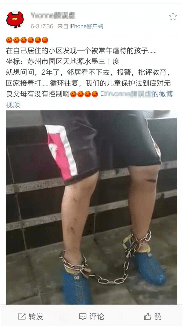 心疼小男孩戴腳鐐在小區內遊蕩腿上傷痕累累鄰居曾多次報警