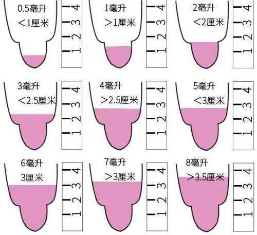 男人注意小蝌蚪出现这种状态或是不育症的信号