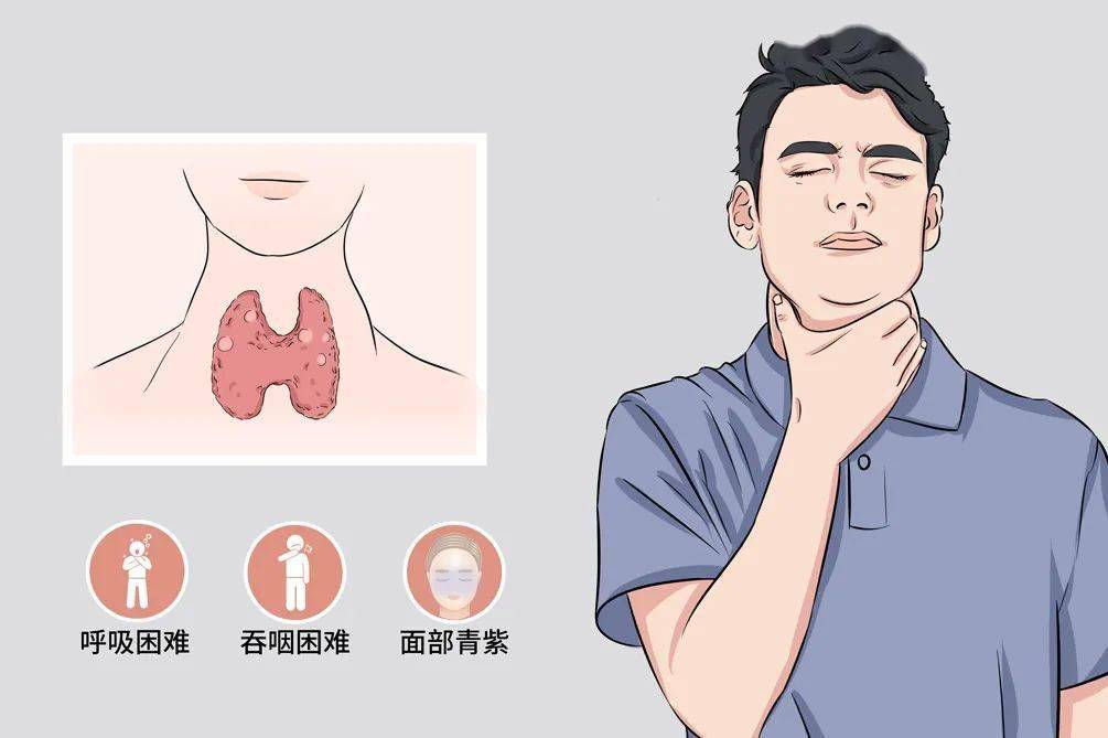 护健图文体检查出来有甲状腺结节怎么办要吃药吗快来看看
