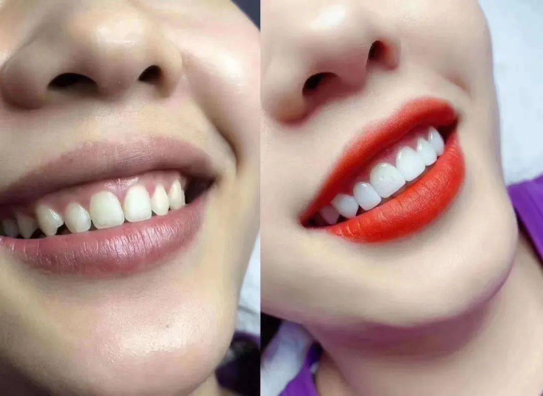 攀枝花这家【美牙制造所】盛大开业,全场5折!解决你的笑容尴尬症