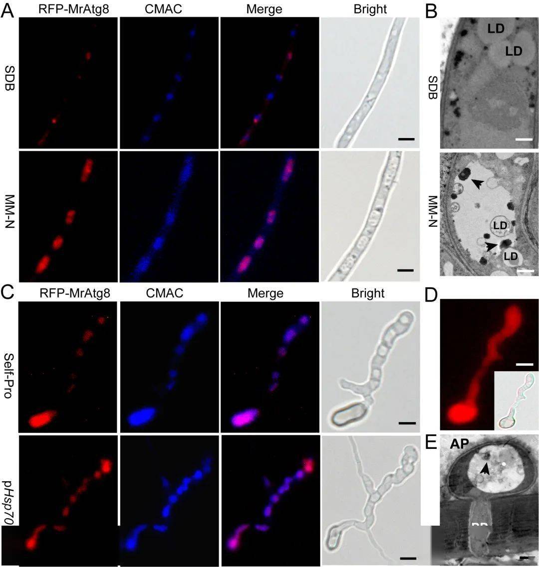 王成树研究组揭示真菌脂滴降解的微自噬途径及功能