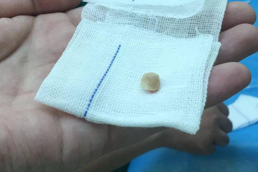 一个炒菜的功夫孩子就没了!儿科医生呼吁:这些底线千万不要让孩子碰!