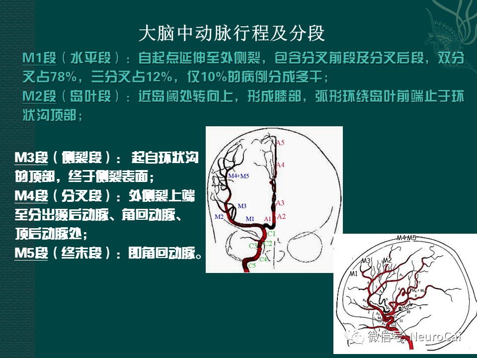 高清圖腦動脈解剖與ct重建