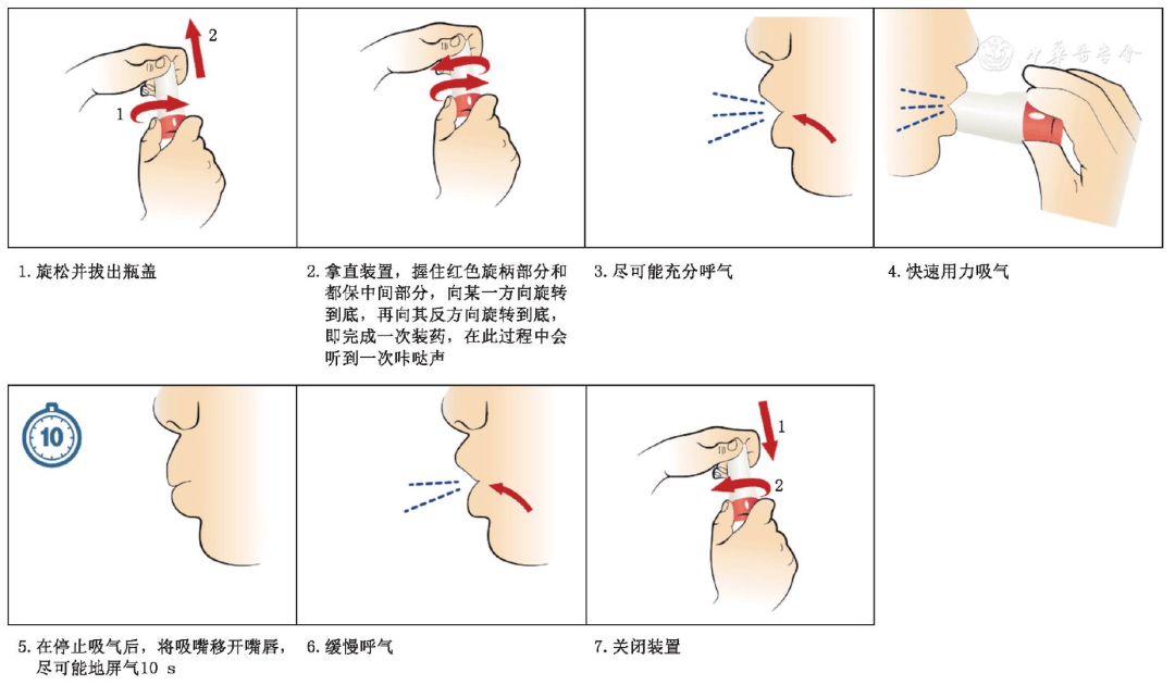 ③ dpi-吸乐%uae操作步骤④ dpi-准纳器%uae操作步骤⑤ dpi-易纳器%u