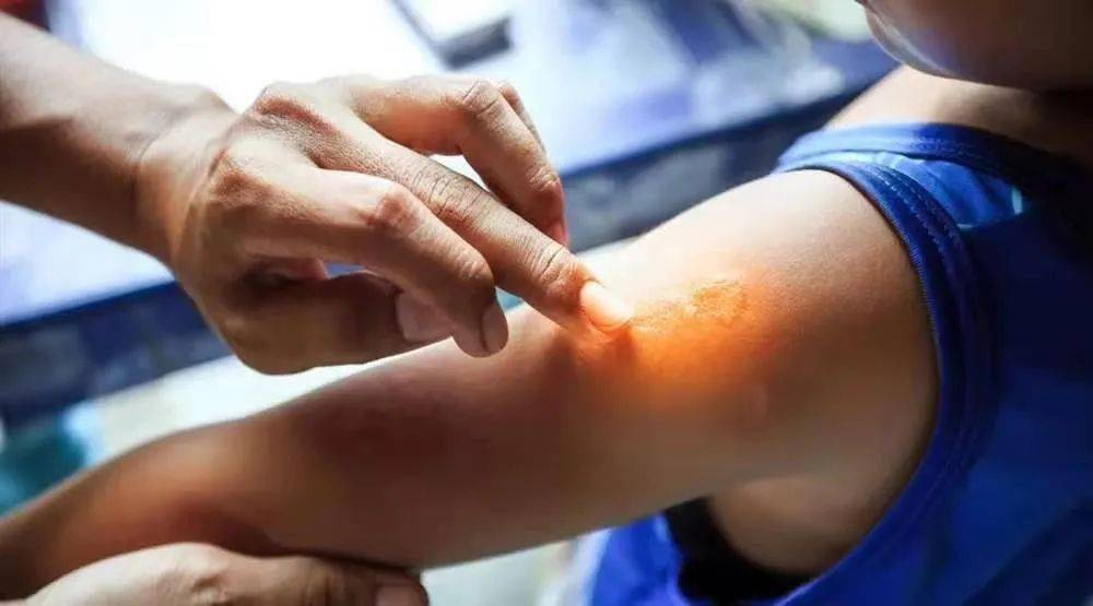 你家可能就有_软膏