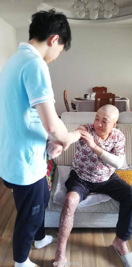 少年两度割皮救父湖北襄阳少年王子豪今年高考考了538分(首选物理)