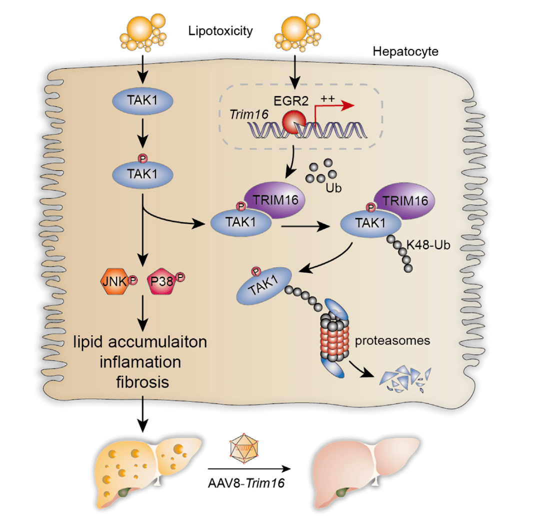 cell metab:西京医院王琳教授团队报道非酒精性脂肪肝炎新靶点_通路