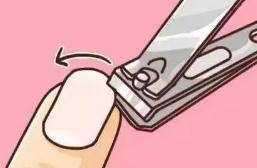 修剪|趾甲没剪对，能让人痛到抓心挠肝撕心裂肺？