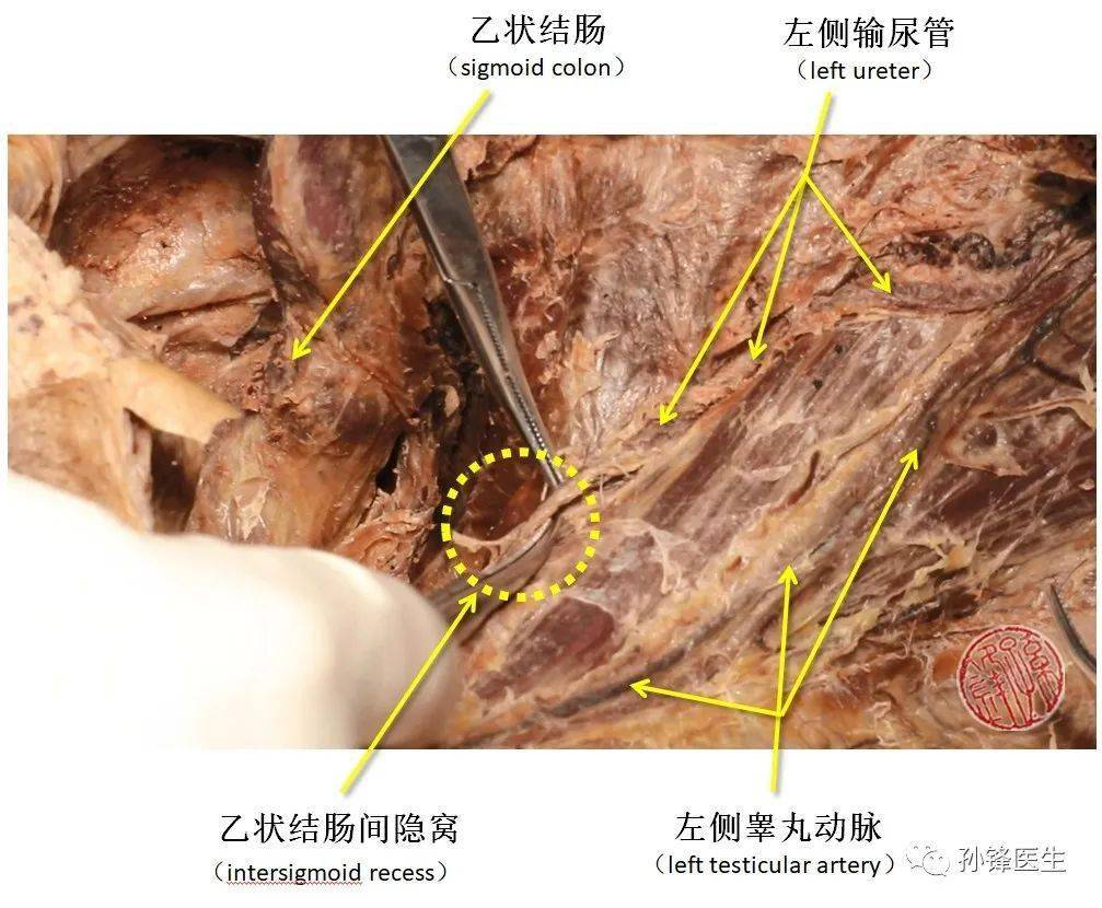 医学笔记输尿管盆部保护的应用解剖图文