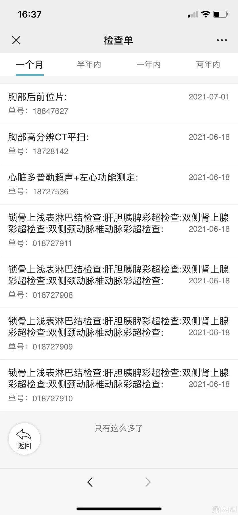 交感神经|萧山姑娘这个尴尬多年的病症，终于下决心做了手术！经历值得一看