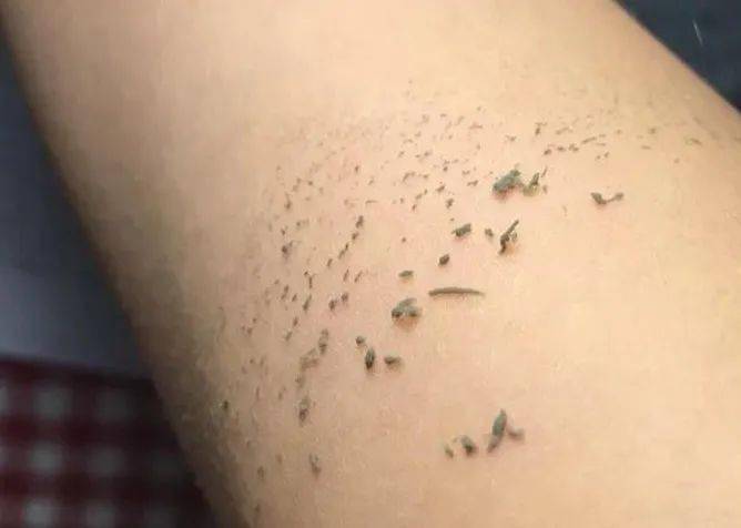 身上搓泥爆痘油腻小心这样洗澡养虫子