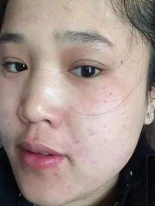 女人过了30岁黄脸婆皮肤保养不当年龄显老10岁