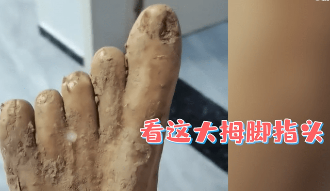 女子买到山药像极了人脚这奇形怪状的山药能吃吗