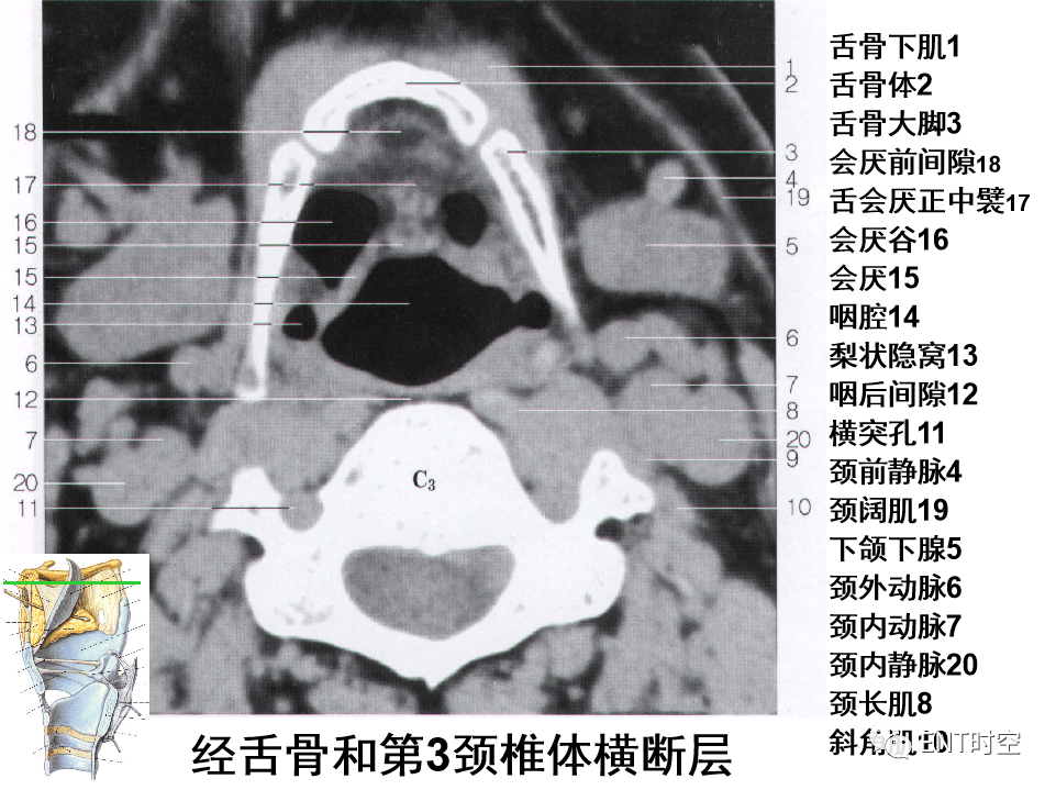 咽部 断层解剖图片